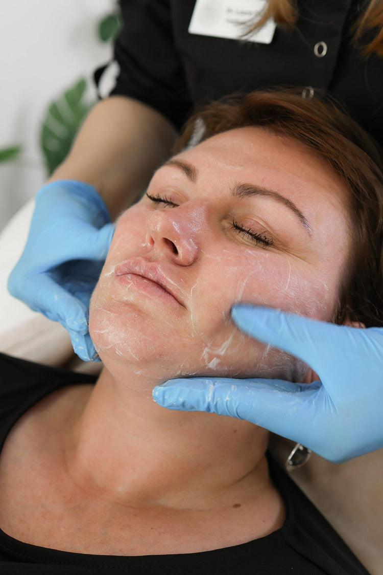 How skin consultations work to treat oily skin and acne